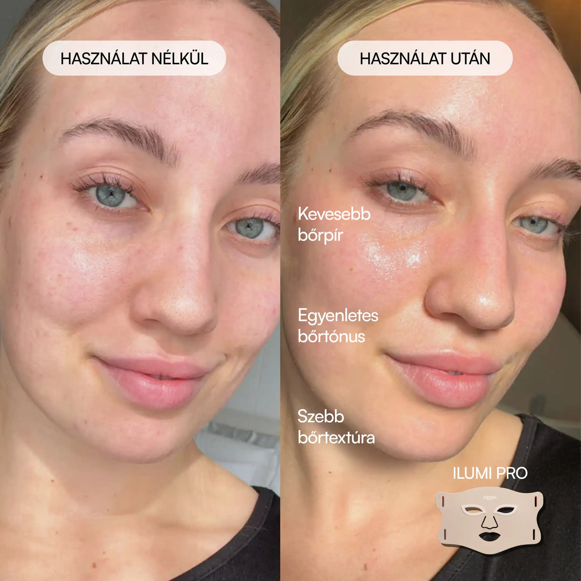 Ilumi Pro